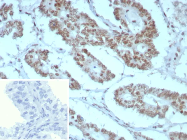 Formalin-fixed, paraffin-embedded human prostate stained with INI-1 Recombinant Mouse Monoclonal Antibody (rINI1/8850) Inset: PBS instead of primary antibody; secondary only negative control.