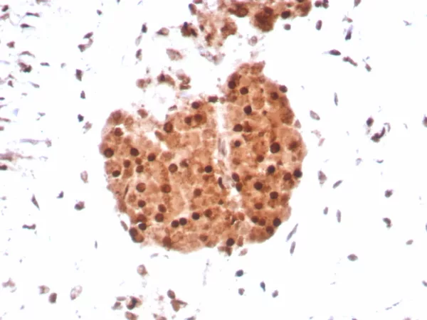 Recombinant Integrase interactor 1 (INI-1) / SNF5 / SMARCB1 Antibody