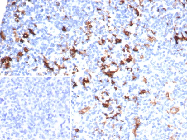 IHC analysis of formalin-fixed, paraffin-embedded human kidney.  Cytoplasmic staining using FSCN1/7207 at 2ug/ml in PBS for 30min RT. Inset: PBS instead of primary antibody; secondary only negative control.