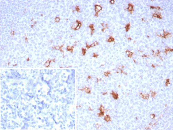 Recombinant SPARC / Osteonectin Antibody