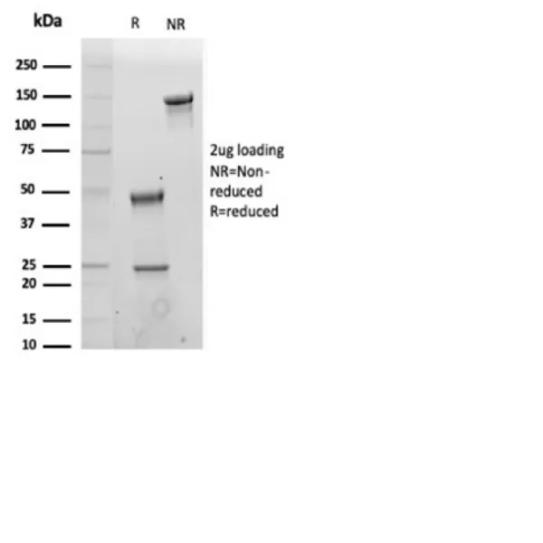 SDS-PAGE Analysis of Purified CD43 Mouse Monoclonal Antibody (MT-1).Confirmation of Integrity and Purity of Antibody.