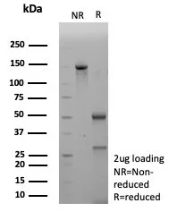 SDS-PAGE Analysis of Purified BRCA1 Mouse Monoclonal Antibody (BRCA1/2973). Confirmation of Integrity and Purity of Antibody.