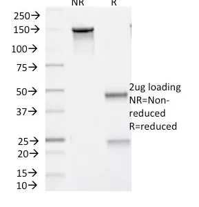 SDS-PAGE Analysis of Purified BRAF Mouse Monoclonal Antibody (V600E/1321). Confirmation of Purity and Integrity of Antibody.