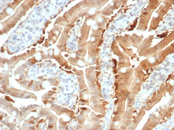 Sulfotransferase family 1E, estrogen-preferring, member 1 Antibody