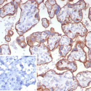 CD147 Antibody in Immunohistochemistry (IHC (P))