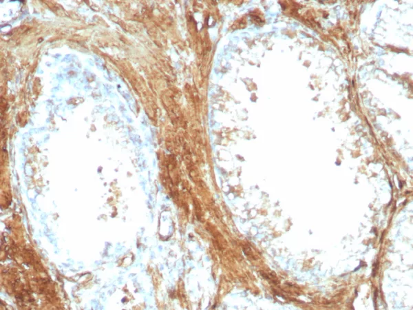 Recombinant Transgelin (SM22-alpha) Antibody