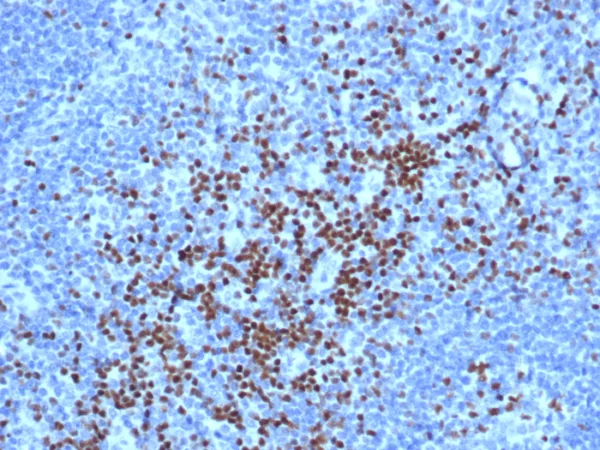 Formalin-fixed, paraffin-embedded human lymph node stained with TCF7 Mouse Monoclonal Antibody (TCF7/7631). HIER: Tris/EDTA, pH9.0, 45min. 2°C: HRP-polymer, 30min. DAB, 5min.