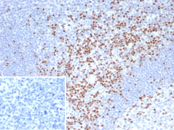 Formalin-fixed, paraffin-embedded human tonsil stained with TCF7 Mouse Monoclonal Antibody (TCF7/7631). Inset: PBS instead of primary antibody; secondary only negative control.