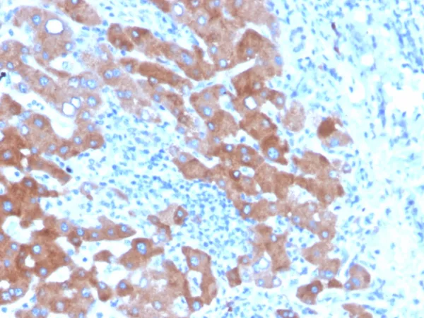 Formalin-fixed, paraffin-embedded human liver stained with Transferrin Mouse Monoclonal Antibody (TF/4796). HIER: Tris/EDTA, pH9.0, 45min. 2°C: HRP-polymer, 30min. DAB, 5min.