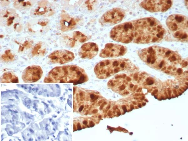 Formalin-fixed, paraffin-embedded human stomach stained with Transferrin Recombinant Rabbit Monoclonal Antibody (TFF1/8755R). HIER: Tris/EDTA, pH9.0, 45min. 2: HRP-polymer, 30min. DAB, 5min.