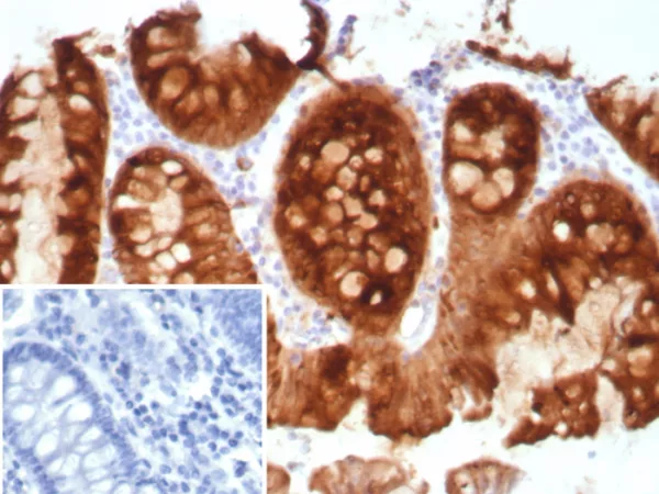 Formalin-fixed, paraffin-embedded human colon stained with Transferrin Recombinant Rabbit Monoclonal Antibody (TFF1/8817R). Inset: PBS instead of primary antibody; secondary only negative control.