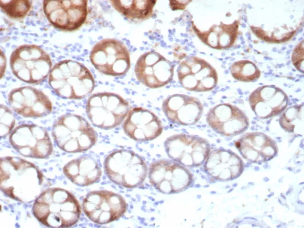 Formalin-fixed, paraffin-embedded human colon stained with Transferrin Recombinant Rabbit Monoclonal Antibody (TFF1/8817R). HIER: Tris/EDTA, pH9.0, 45min. 2°C: HRP-polymer, 30min. DAB, 5min