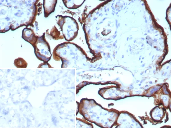 Formalin-fixed, paraffin-embedded human placenta stained with CD71 Rabbit Recombinant Monoclonal Antibody (TFRC/9106R). Inset: PBS instead of primary antibody; secondary only negative control.