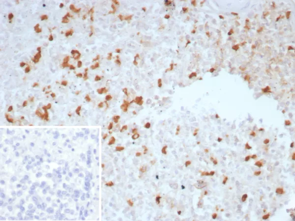 Formalin-fixed, paraffin-embedded human spleen stained with TGF beta Mouse Monoclonal Antibody (TGFB/7230). Inset: PBS instead of primary antibody; secondary only negative control.