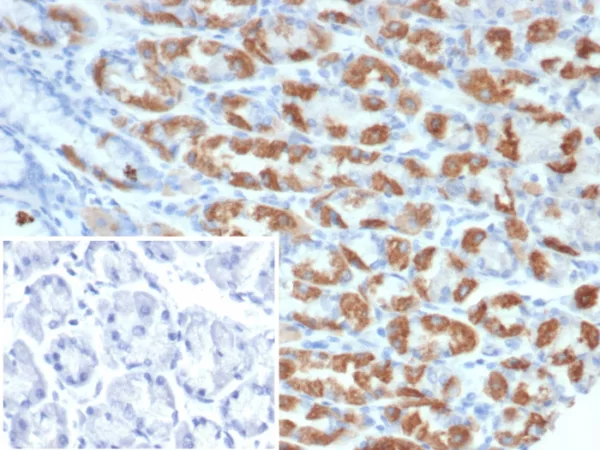 Formalin-fixed, paraffin-embedded human stomach stained with Thrombospondin-1 / THBS1 Mouse Monoclonal Antibody (THBS1/4532). Inset: PBS instead of primary antibody; secondary only negative control.