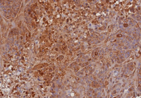 Recombinant TIMP2 (Tissue Inhibitor of Metalloproteinase 2) Antibody