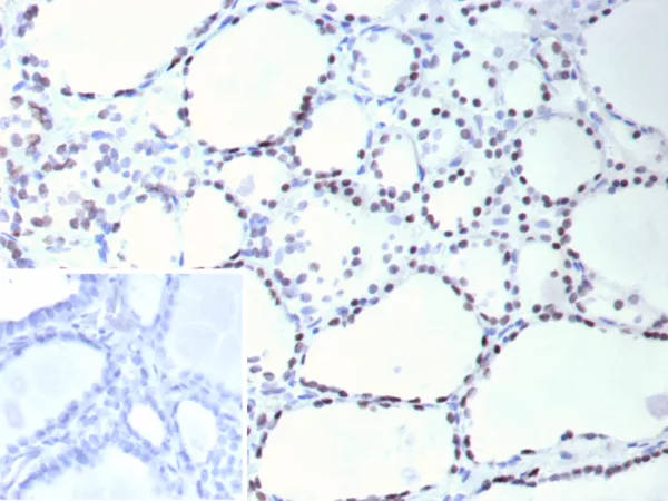 Formalin-fixed, paraffin-embedded human thyroid stained with TTF-1 Mouse Monoclonal Antibody (NX2.1/9036). Inset: PBS instead of primary antibody; secondary only negative control.