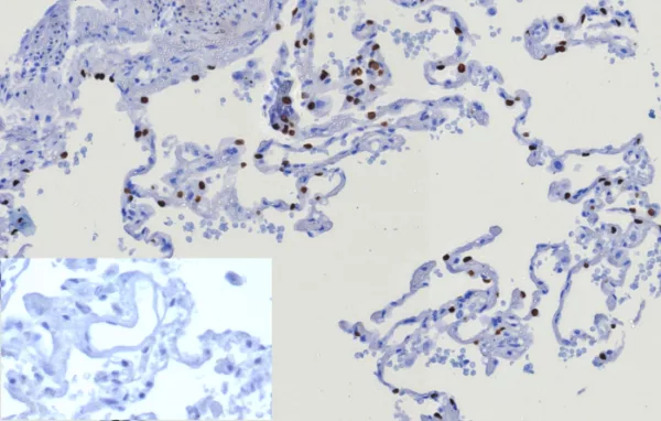 Recombinant TTF-1 / NKX2.1 (Thyroid & Lung Epithelial Marker) Antibody