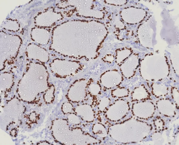 Recombinant TTF-1 / NKX2.1 (Thyroid & Lung Epithelial Marker) Antibody - Image 2