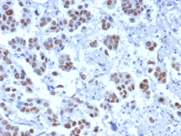 Formalin-fixed, paraffin-embedded human bladder stained with TLE1 Rabbit Recombinant Monoclonal Antibody (TLE1/8007R). HIER: Tris/EDTA, pH9.0, 45min. 2: HRP-polymer, 30min. DAB, 5min.