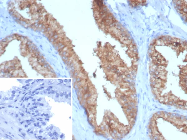 Formalin-fixed, paraffin-embedded human prostate stained with TMPRSS2 Mouse Monoclonal Antibody (TMPRSS2/7410). Inset: PBS instead of primary antibody; secondary only negative control.