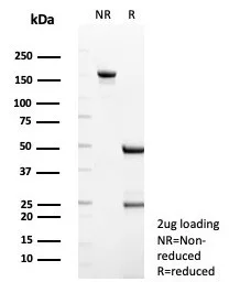 SDS-PAGE Analysis of Purified TMPRSS2 Mouse Monoclonal Antibody (TMPRSS2/7420). Confirmation of Purity and Integrity of Antibody.