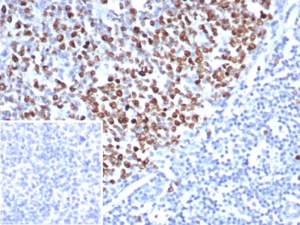 Formalin-fixed, paraffin-embedded human tonsil stained with Topo II alpha Recombinant Mouse Monoclonal Antibody (rTOP2A/8339). Inset: PBS instead of primary antibody; secondary only negative control.