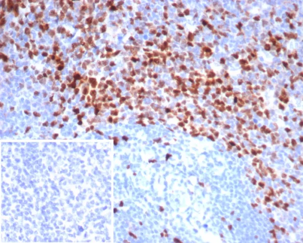 Formalin-fixed, paraffin-embedded human tonsil stained with Topo IIa Recombinant Rabbit Monoclonal Antibody (TOP2A/7169R). Inset: PBS instead of primary antibody; secondary only negative control.