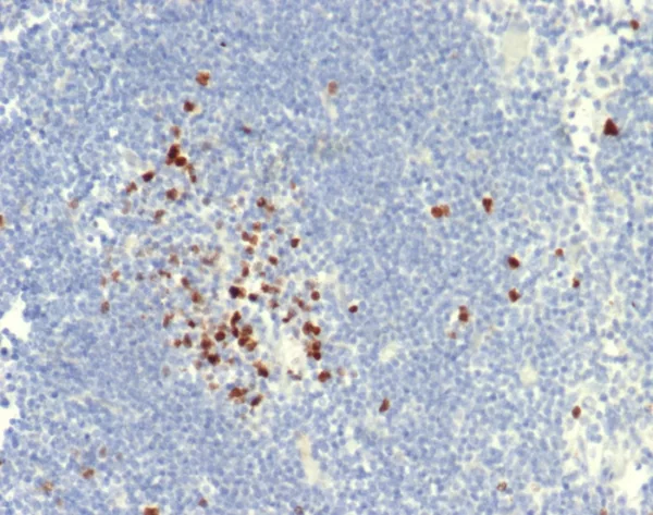 Formalin-fixed, paraffin-embedded dog lymph node stained with Topo IIa Recombinant Rabbit Monoclonal Antibody (TOP2A/7169R). HIER: Tris/EDTA, pH9.0, 45min. 2°C: HRP-polymer, 30min. DAB, 5min.