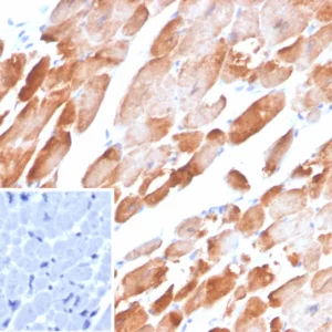 Formalin-fixed, paraffin-embedded human heart stained with Tropomyosin Mouse Monoclonal Antibody (TPM1/4510). Inset: PBS instead of primary antibody; secondary only negative control.