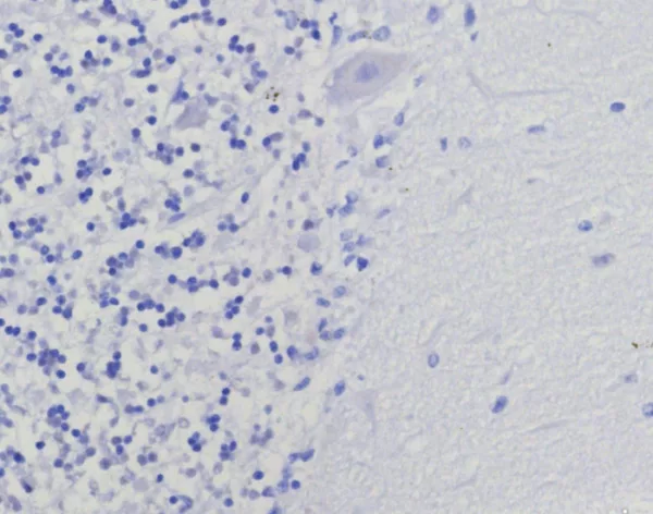 IHC analysis of formalin-fixed, paraffin-embedded human brain. Negative tissue control using TYMS/9091R at 2ug/ml in PBS for 30min RT.  HIER: Tris/EDTA, pH9.0, 45min. 2°C: HRP-polymer, 30min. DAB, 5min.