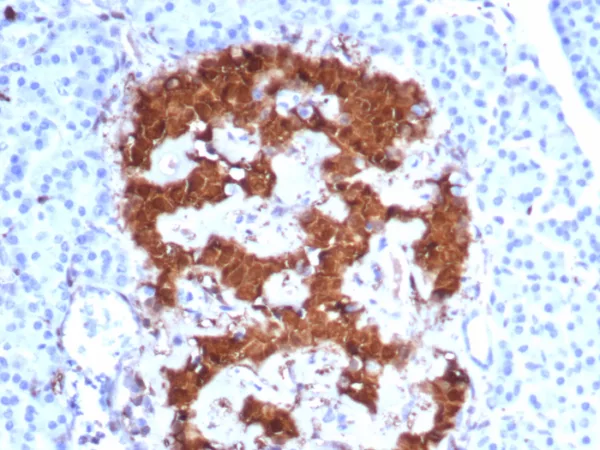 PGP9.5 / UchL1 (pan-Neuronal Marker) Antibody - Image 3