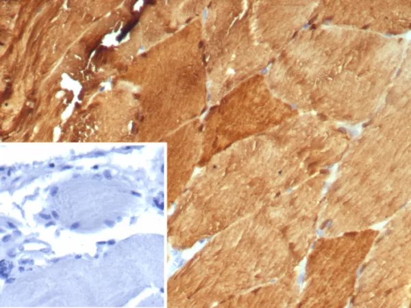 Formalin-fixed, paraffin-embedded human skeletal muscle stained with CA3 Mouse Monoclonal Antibody (CA3/7885). Inset: PBS instead of primary antibody; secondary only negative control.