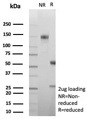 SDS-PAGE Analysis of Purified CA8 Recombinant Rabbit Monoclonal Antibody (CA8/8605R). Confirmation of Purity and Integrity of Antibody.