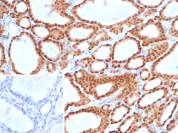 Recombinant PAX8 (Renal Cell Marker) Antibody