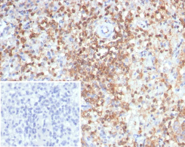 Formalin-fixed, paraffin-embedded human spleen stained with S100G Mouse Monoclonal Antibody (S100G/7516). Inset: PBS instead of primary antibody; secondary only negative control.