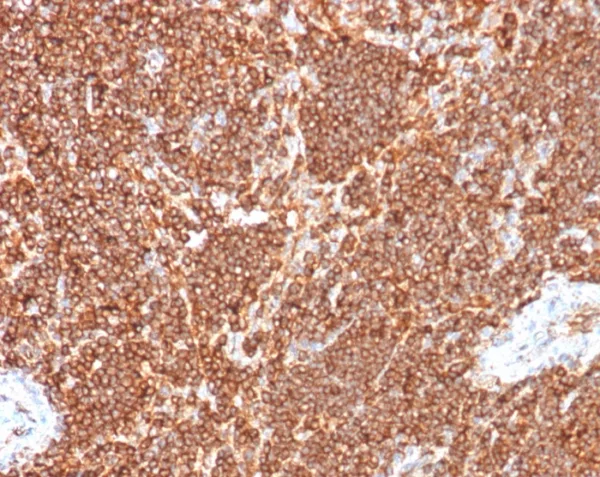 Formalin-fixed, paraffin-embedded human lymph node stained with S100G Mouse Monoclonal Antibody (S100G/7516). HIER: Tris/EDTA, pH9.0, 45min. 2°C: HRP-polymer, 30min. DAB, 5min.