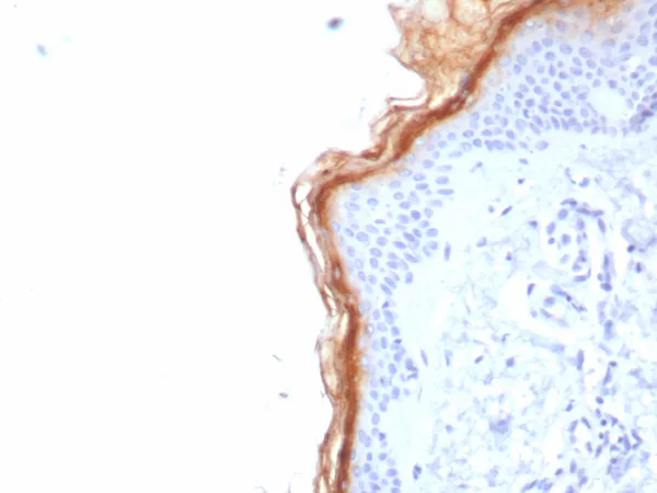 Formalin-fixed, paraffin-embedded human skin stained with S100G Mouse Monoclonal Antibody (S100G/7517). HIER: Tris/EDTA, pH9.0, 45min. 2°C: HRP-polymer, 30min. DAB, 5min.