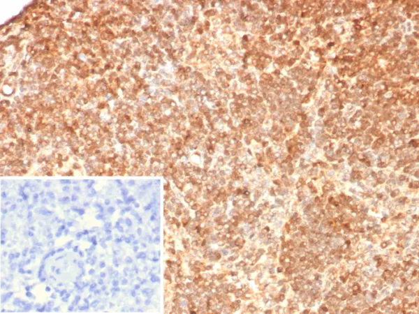 Formalin-fixed, paraffin-embedded human lymph node stained with S100G Mouse Monoclonal Antibody (S100G/7517). Inset: PBS instead of primary antibody; secondary only negative control.