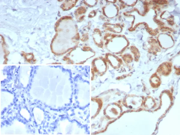 Recombinant Calcitonin Antibody - Image 2