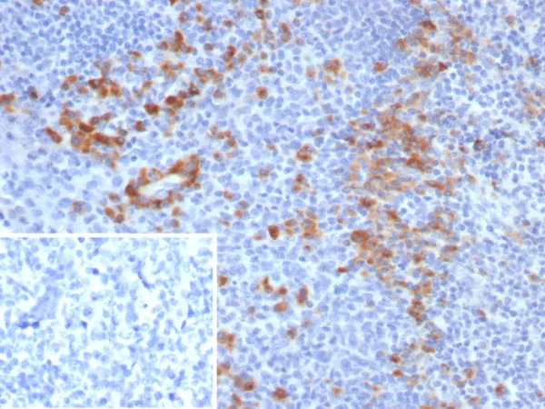 Formalin-fixed, paraffin-embedded human tonsil stained with CD276 / B7-H3 Mouse Monoclonal Antibody (B7H3/4479) at 2ug/ml. Inset: PBS instead of primary antibody; secondary only negative control.