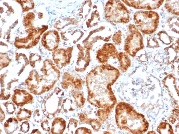 IHC analysis of formalin-fixed, paraffin-embedded human kidney stained using FGF23/6404 at 2ug/ml in PBS for 30min RT. HIER: Tris/EDTA, pH9.0, 45min. 2°C: HRP-polymer, 30min. DAB, 5min.