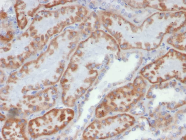 IHC analysis of formalin-fixed, paraffin-embedded human kidney stained using FGF23/6419 at 2ug/ml in PBS for 30min RT. HIER: Tris/EDTA, pH9.0, 45min. 2°C: HRP-polymer, 30min. DAB, 5min.