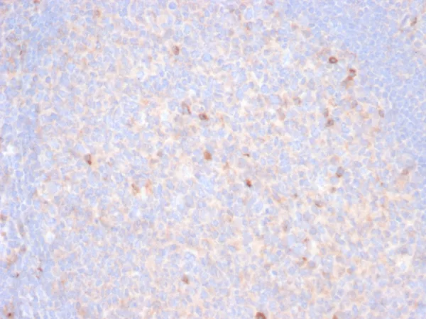 Formalin-fixed, paraffin-embedded human tonsil stained with TIM3 Recombinant Rabbit Monoclonal Antibody (TIM3/6863R). HIER: Tris/EDTA, pH9.0, 45min. 2°C: HRP-polymer, 30min. DAB, 5min.