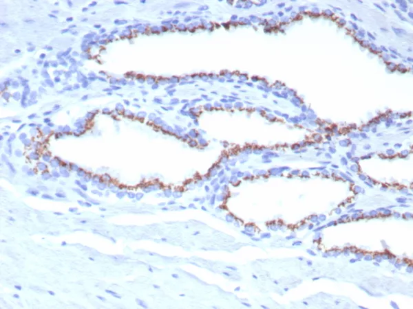 Prostein (p501S) / Solute Carrier Family 45 Member 3 (SLC45A3) Antibody - Image 2