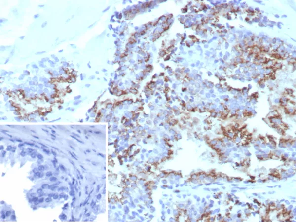 Formalin-fixed, paraffin-embedded human prostate stained with Prostein (p501S) Mouse Monoclonal Antibody (SLC45A3/7648). Inset: PBS instead of primary antibody; secondary only negative control.