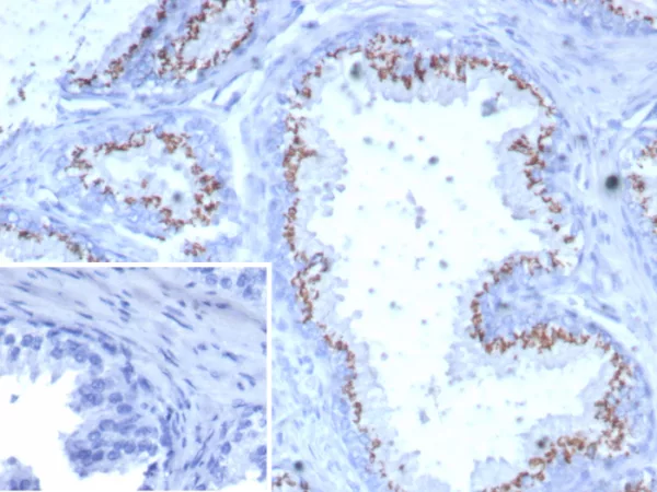 Formalin-fixed, paraffin-embedded human prostate stained with Prostein (p501S) Mouse Monoclonal Antibody (SLC45A3/7649). Inset: PBS instead of primary antibody; secondary only negative control.