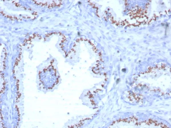 Formalin-fixed, paraffin-embedded human prostate stained with Prostein (p501S) Mouse Monoclonal Antibody (SLC45A3/7649). HIER: Tris/EDTA, pH9.0, 45min. 2°C: HRP-polymer, 30min. DAB, 5min.