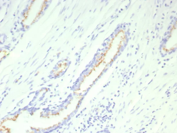 Recombinant Prostein (p501S) / Solute Carrier Family 45 Member 3 (SLC45A3) Antibody