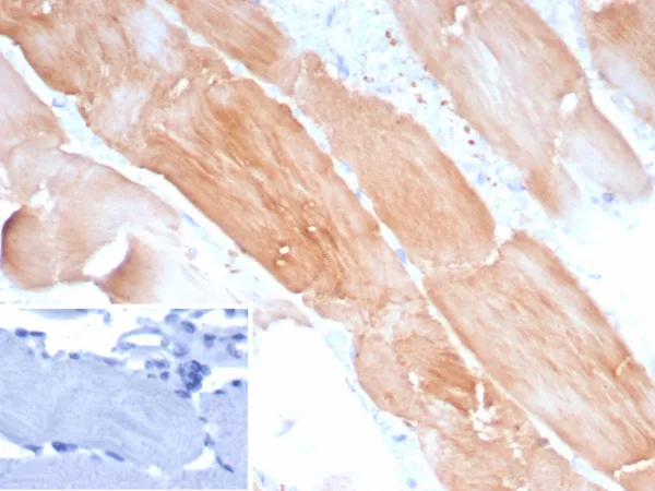 Recombinant Sarcomeric Actinin Alpha 2 / ACTN2 Antibody